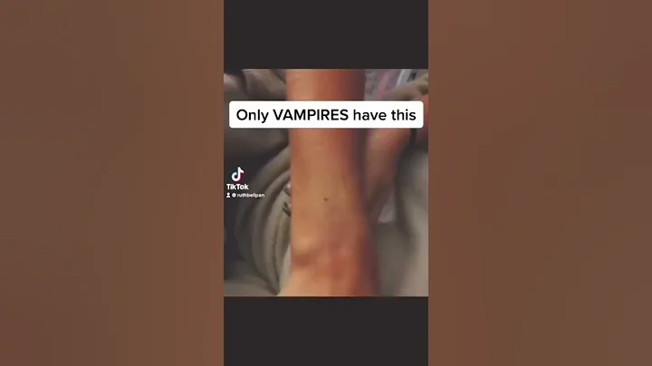 Seeing if I have the Vampire Mark #shorts