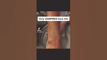 Seeing If I Have The Vampire Mark Shorts 