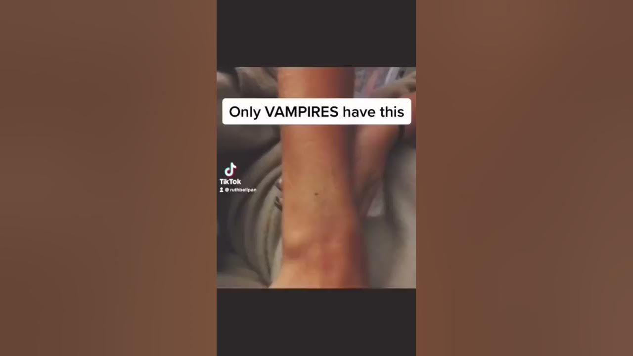 Seeing if I have the Vampire Mark #shorts