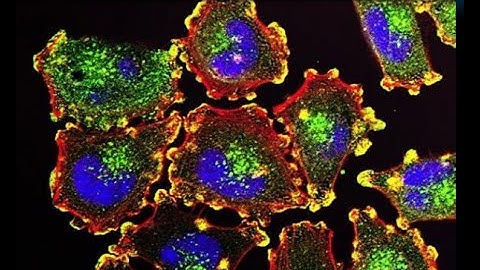 Morgridge Seminar: Imaged-based profiling for drug discovery