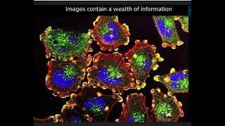 Morgridge Seminar: Imaged-based profiling for drug discovery