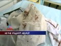 Congress group activist injured clashes