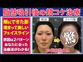 【症例解説】脂肪吸引後の頬コケが気になる20代