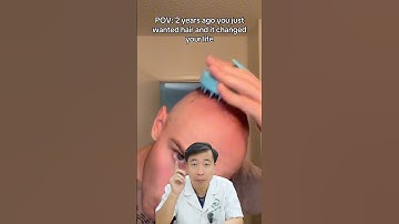 Chữa hói bằng minoxidil và finasteride không sai !!! #blackhair #caytoc #caytocblackhair