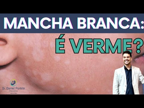 Vídeo: Manchas ásperas no corpo de uma criança