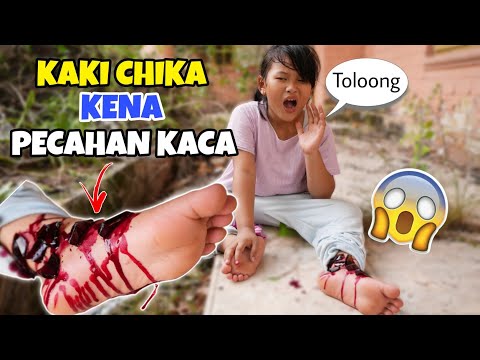 KAKI CHIKA KENA PECAHAN KACA KASIHAN | CHIKAKU CHANNEL