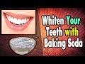 How to Whiten Your Teeth with Baking Soda [CONFIRMED!!!] | Best of 2017 | Health Doctor