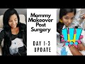 Post Op Day 1-3 Update Mommy Makeover Surgery! Sharing ALL the details!