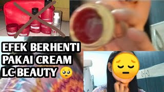 ALASAN BERHENTI PAKAI CREAM LC BEAUTY