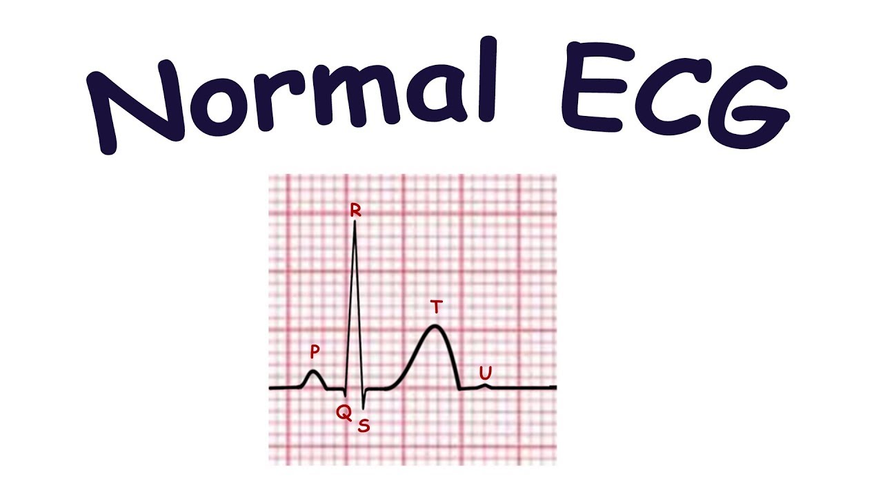 How To Read A Normal Ecgelectrocardiogram Hubpages - Reverasite