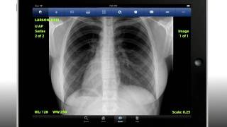 The iClarity iPad App From iCRco screenshot 5