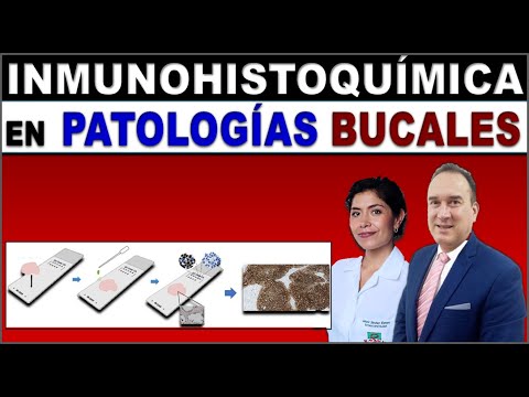 IMMUNOHISTOKEMI I DIAGNOSE AV ORAL PATOLOGI