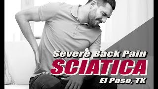  Severe Sciatica Back Pain Relief El Paso Tx 2019 