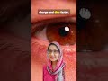 Glaucoma The Battery That Never Recharges #glaucoma #health #awareness