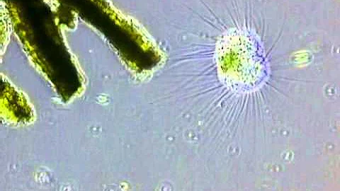 Actinosphaerium eichhorni  Солнечники