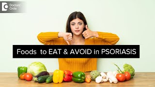 FOODS TO TAKE & AVOID IN PSORIASIS | Avoid Psoriasis FlareUps  Dr Divya Sharma | Doctors' Circle