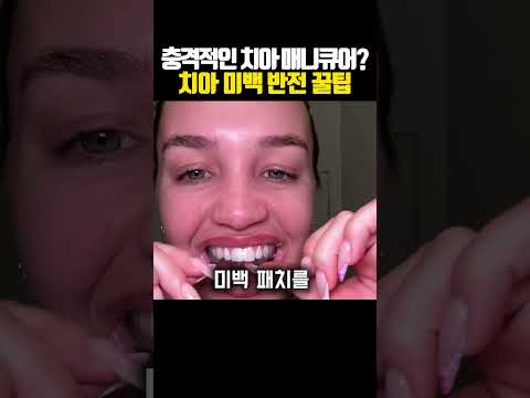 충격적인 치아 <strong>매니큐어</strong>? 치아 미백 반전 꿀팁