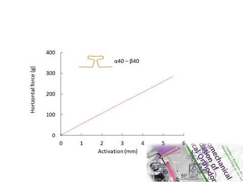 20210226 Part 2  An additional moment is required for the T loop spring to translate a tooth