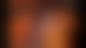 Laparoscopic spleen preserving distal pancreatectomy for SPT with bleeding from splenic vein.