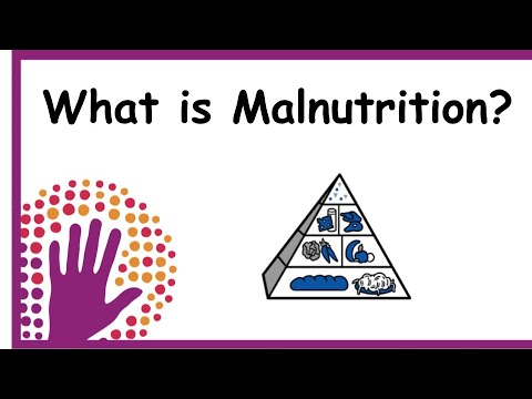 What is Malnutrition?