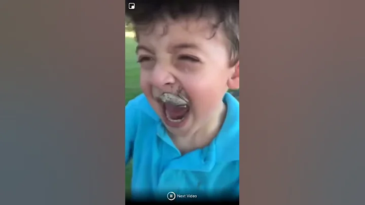 Frog on boy *jumps on face*