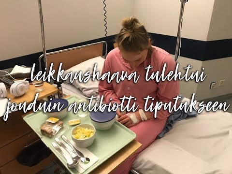 Video: Kuinka Saada äänesi Takaisin Nopeasti, Kun Sinulla On Kurkunpääntulehdus