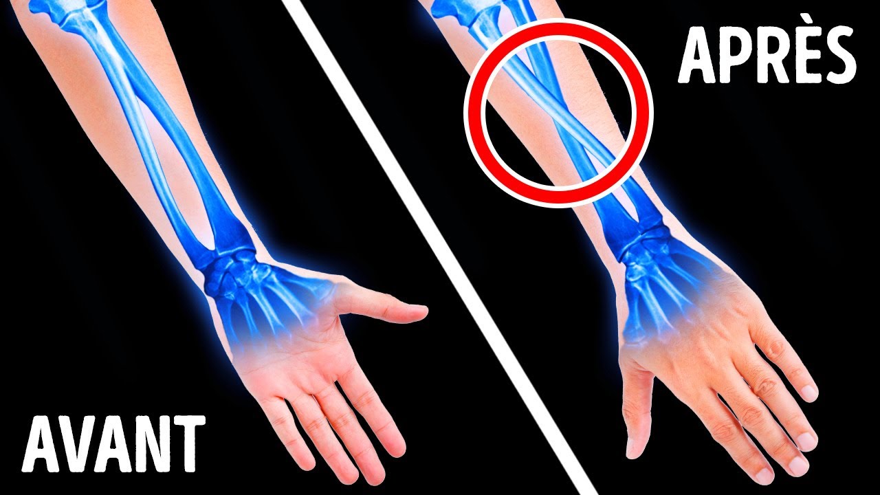 Voici Comment Les Os Du Bras Se Croisent Lorsque Tu Tends Ta main + D