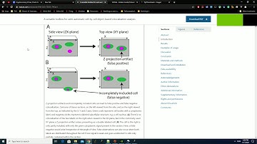 ImageJ/FIJI plugin: Semi-automatic cell-by-cell object-based colocalization analysis - PART 1