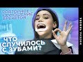 СНОВА БРЕКЕТЫ! Что случилось с моими зубами? Повторное ношение брекетов