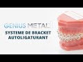 Genius Metal : Système de bracket autoligaturant
