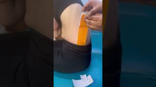 Low back pain healed with kinesiology tape  kinesiology physio physiotherapy physiotherapy