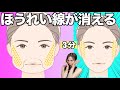 【たった3分】ブルドッグ顔とほうれい線!顔のたるみをとる方法【40〜50代必見】