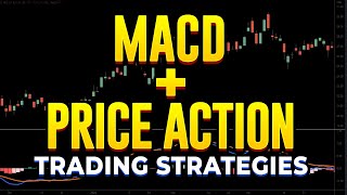 Best MACD + Price Action Trading Strategy You&#39;ll Ever Find!