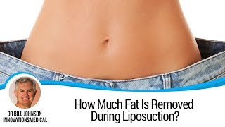 How Much Fat Is Removed During Liposuction? Innovations Medical Texas