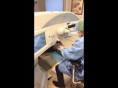 LIVE optagelse af SMILE laseroperation ved øjenlæge Peter Brincker - Øjenhospitalet Danmark