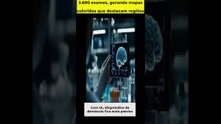 Com IA, diagnu00f3stico de demu00eancia fica mais preciso