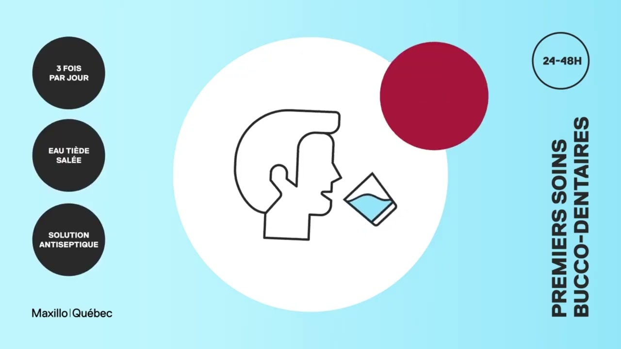 vidéo salle d'attente - Maxillo Québec