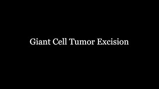 Giant Cell Tumor Excision of Finger