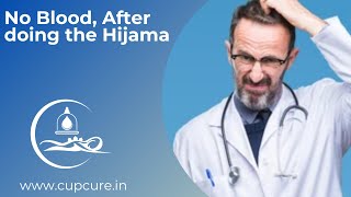 FAQ#3 | Hijama kiya par koi blood nahi Nikla?