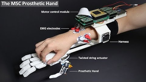 Prosthetic Robot Hand controlled by EMG –Twisted String Actuation, Box and Block Test(BBT)