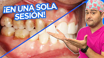 ¿Los arándanos manchan los dientes?