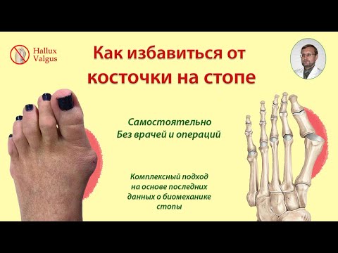 Антикосточка