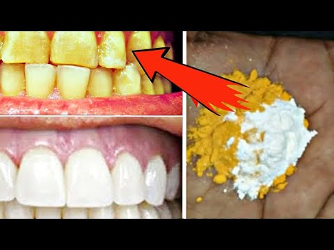 Video: Dişlərin Zərər Görməməsi üçün