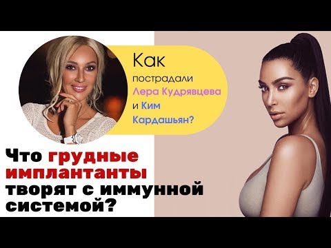 ОПАСНОСТЬ ГРУДНЫХ ИМПЛАНТАНТОВ. ЛЕРА КУДРЯВЦЕВА И КИМ КАРДАШЬЯН.