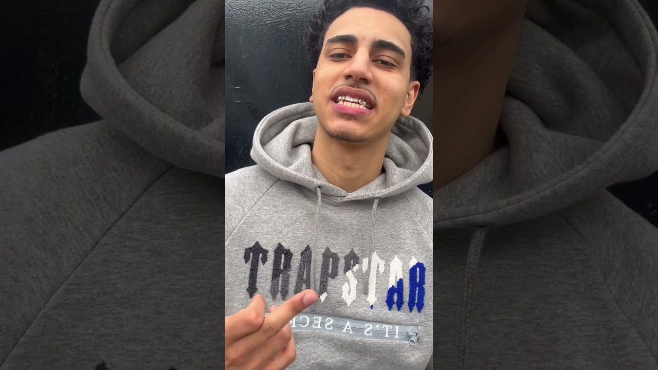 Crazy set of silver grillz🔥