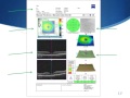 OCT Tutorial On Interpreting Cirrus OCT Macular Scans