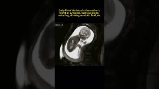 12 Week Fetus Kicking, Urinating & Drinking Amniotic Fluid in the Mother's Womb #pregnancy #shorts