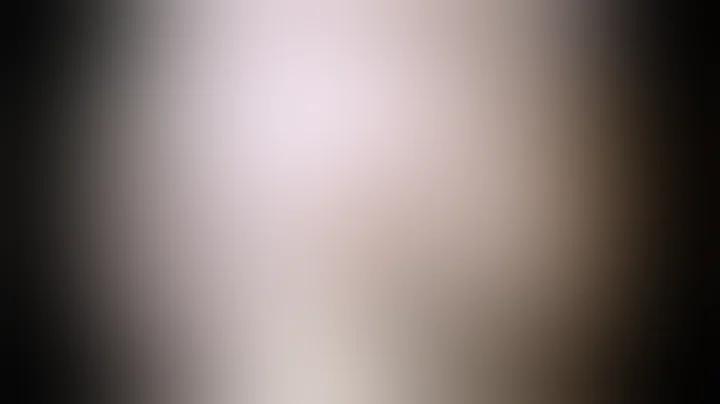 OCD Lesion – Knee Arthroscopy with Cartilage Repair and Regeneration