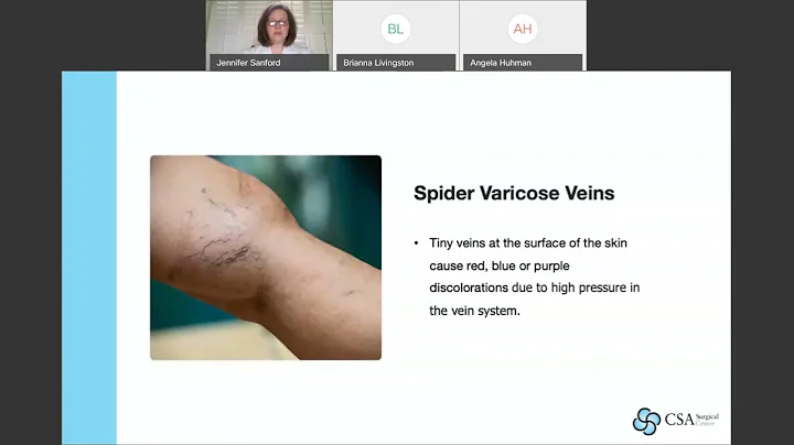 Vein Disease & Treatment Options with Dr. Jennifer...