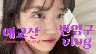 [VLOG DAILY] 필러💉맞기 무서워서 한 애교살 타투 후기....😎 (쌩얼주의)